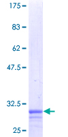 ZC3HC1 / NIPA Protein - 12.5% SDS-PAGE of human ZC3HC1 stained with Coomassie Blue