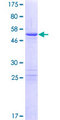 ZC4H2 Protein - 12.5% SDS-PAGE of human KIAA1166 stained with Coomassie Blue