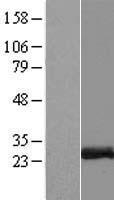 ZCCHC10 Protein - Western validation with an anti-DDK antibody * L: Control HEK293 lysate R: Over-expression lysate