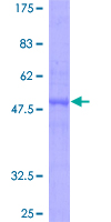 ZCCHC10 Protein - 12.5% SDS-PAGE of human ZCCHC10 stained with Coomassie Blue