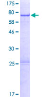 ZCCHC12 Protein - 12.5% SDS-PAGE of human ZCCHC12 stained with Coomassie Blue