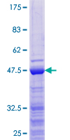 ZCCHC13 Protein - 12.5% SDS-PAGE of human ZCCHC13 stained with Coomassie Blue
