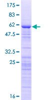 ZCCHC17 / PNO40 / PS1D Protein - 12.5% SDS-PAGE of human ZCCHC17 stained with Coomassie Blue