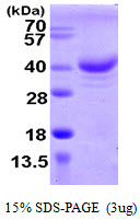 ZCCHC17 / PNO40 / PS1D Protein