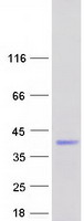 ZCCHC17 / PNO40 / PS1D Protein - Purified recombinant protein ZCCHC17 was analyzed by SDS-PAGE gel and Coomassie Blue Staining