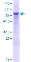 ZCCHC2 Protein - 12.5% SDS-PAGE of human ZCCHC2 stained with Coomassie Blue