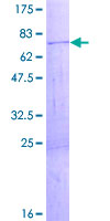 ZCCHC3 Protein - 12.5% SDS-PAGE of human ZCCHC3 stained with Coomassie Blue