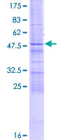 ZCCHC4 Protein - 12.5% SDS-PAGE of human ZCCHC4 stained with Coomassie Blue
