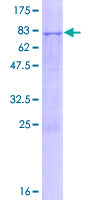 ZCCHC6 Protein - 12.5% SDS-PAGE of human ZCCHC6 stained with Coomassie Blue