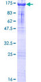ZCCHC8 Protein - 12.5% SDS-PAGE of human ZCCHC8 stained with Coomassie Blue