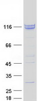 ZCCHC8 Protein - Purified recombinant protein ZCCHC8 was analyzed by SDS-PAGE gel and Coomassie Blue Staining