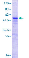 ZCCHC9 Protein - 12.5% SDS-PAGE of human ZCCHC9 stained with Coomassie Blue