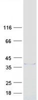 ZCCHC9 Protein - Purified recombinant protein ZCCHC9 was analyzed by SDS-PAGE gel and Coomassie Blue Staining