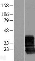 ZCRB1 Protein - Western validation with an anti-DDK antibody * L: Control HEK293 lysate R: Over-expression lysate