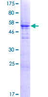 ZCRB1 Protein - 12.5% SDS-PAGE of human ZCRB1 stained with Coomassie Blue