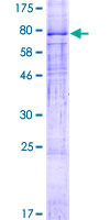 ZDHHC1 Protein - 12.5% SDS-PAGE of human ZDHHC1 stained with Coomassie Blue