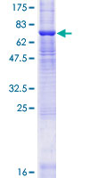 ZDHHC11 Protein - 12.5% SDS-PAGE of human ZDHHC11 stained with Coomassie Blue