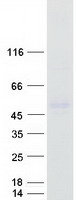 ZDHHC11 Protein - Purified recombinant protein ZDHHC11 was analyzed by SDS-PAGE gel and Coomassie Blue Staining