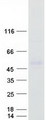ZDHHC11 Protein - Purified recombinant protein ZDHHC11 was analyzed by SDS-PAGE gel and Coomassie Blue Staining