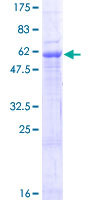 ZDHHC12 Protein - 12.5% SDS-PAGE of human ZDHHC12 stained with Coomassie Blue