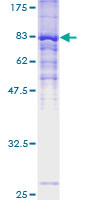 ZDHHC13 / HIP14L Protein - 12.5% SDS-PAGE of human ZDHHC13 stained with Coomassie Blue