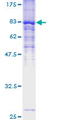 ZDHHC13 / HIP14L Protein - 12.5% SDS-PAGE of human ZDHHC13 stained with Coomassie Blue