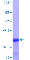 ZDHHC13 / HIP14L Protein - 12.5% SDS-PAGE Stained with Coomassie Blue.