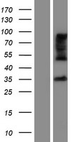 ZDHHC15 Protein - Western validation with an anti-DDK antibody * L: Control HEK293 lysate R: Over-expression lysate