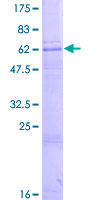 ZDHHC15 Protein - 12.5% SDS-PAGE of human ZDHHC15 stained with Coomassie Blue