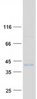ZDHHC15 Protein - Purified recombinant protein ZDHHC15 was analyzed by SDS-PAGE gel and Coomassie Blue Staining