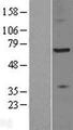 ZDHHC17 Protein - Western validation with an anti-DDK antibody * L: Control HEK293 lysate R: Over-expression lysate