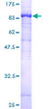 ZDHHC17 Protein - 12.5% SDS-PAGE of human ZDHHC17 stained with Coomassie Blue