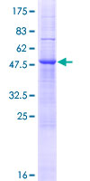 ZDHHC19 Protein - 12.5% SDS-PAGE of human ZDHHC19 stained with Coomassie Blue