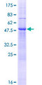 ZDHHC19 Protein - 12.5% SDS-PAGE of human ZDHHC19 stained with Coomassie Blue