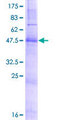 ZDHHC21 Protein - 12.5% SDS-PAGE of human ZDHHC21 stained with Coomassie Blue