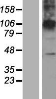 ZDHHC23 Protein - Western validation with an anti-DDK antibody * L: Control HEK293 lysate R: Over-expression lysate
