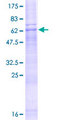 ZDHHC23 Protein - 12.5% SDS-PAGE of human ZDHHC23 stained with Coomassie Blue