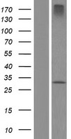 ZDHHC24 Protein - Western validation with an anti-DDK antibody * L: Control HEK293 lysate R: Over-expression lysate