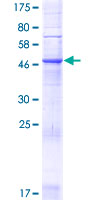 ZDHHC24 Protein - 12.5% SDS-PAGE of human ZDHHC24 stained with Coomassie Blue