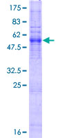 ZDHHC3 Protein - 12.5% SDS-PAGE of human ZDHHC3 stained with Coomassie Blue