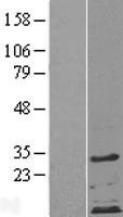 ZDHHC4 Protein - Western validation with an anti-DDK antibody * L: Control HEK293 lysate R: Over-expression lysate