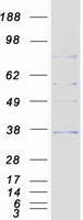 ZDHHC4 Protein - Purified recombinant protein ZDHHC4 was analyzed by SDS-PAGE gel and Coomassie Blue Staining