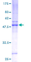 ZDHHC7 Protein - 12.5% SDS-PAGE of human ZDHHC7 stained with Coomassie Blue