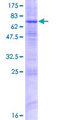 ZDHHC9 Protein - 12.5% SDS-PAGE of human ZDHHC9 stained with Coomassie Blue