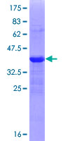 ZEB1 / AREB6 Protein - 12.5% SDS-PAGE Stained with Coomassie Blue.