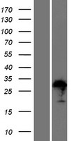 ZFAND1 Protein - Western validation with an anti-DDK antibody * L: Control HEK293 lysate R: Over-expression lysate