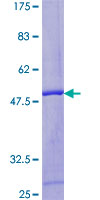ZFAND1 Protein - 12.5% SDS-PAGE of human ZFAND1 stained with Coomassie Blue