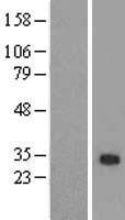 ZFAND2B Protein - Western validation with an anti-DDK antibody * L: Control HEK293 lysate R: Over-expression lysate