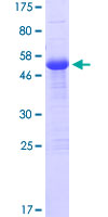 ZFAND2B Protein - 12.5% SDS-PAGE of human ZFAND2B stained with Coomassie Blue
