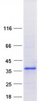 ZFAND2B Protein - Purified recombinant protein ZFAND2B was analyzed by SDS-PAGE gel and Coomassie Blue Staining